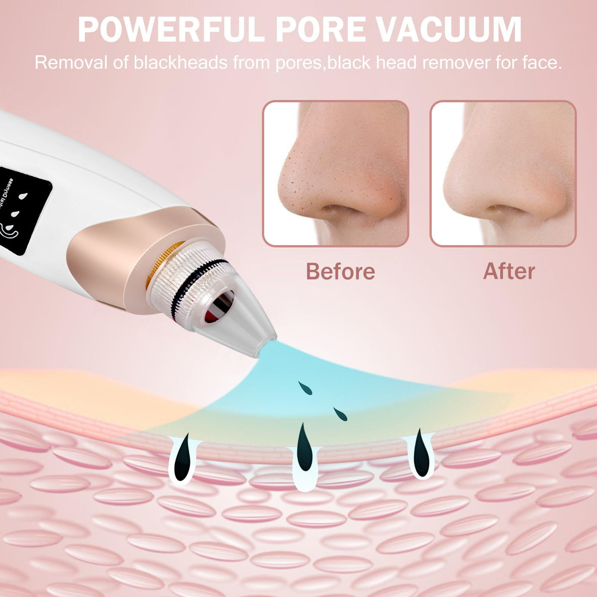 Facial Vacuum & Blackhead Remover – Pore Cleaning Tool